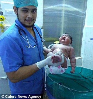 Bác sĩ địa phương Venkatesh Raju cho biết trong nhiều năm làm nghề hộ sinh, ông chưa từng gặp em bé sơ sinh nào nặng cân như vậy. "Đây có thể là em bé nặng cân nhất thế giới", ông Venkatesh chia sẻ