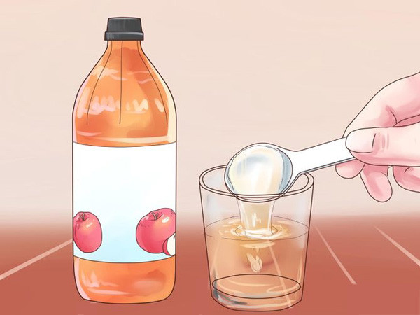Giấm táo, nước và baking soda (bột nở). Giấm táo khi trộn với baking soda rất có hiệu quả trong điều trị sỏi thận. Tác dụng kiềm hoá của soda giúp loại bỏ axit khỏi cơ thể. Cho 2 thìa giấm và 1/2 thìa baking soda vào 1 cốc nước. Uống loại nước này 3 lần mỗi ngày để đạt hiệu quả tốt nhất. Ảnh: Vivawhite.vn