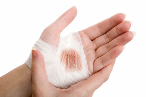 Điều trị vết thương mở. 29% rửa sạch với nước và băng bó, 40% để nó tự đóng vảy và 31% khử trùng bằng oxy già. Thật bất ngờ, cả 3 điều trên bạn đều làm sai.