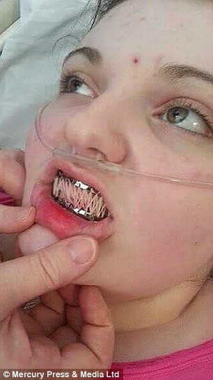 Căn bệnh lạ này khiến cho sinh hoạt của cô bé vô cùng khó khăn, Emily không thể ngồi học bài vì khớp sẽ rơi khi cô bé ngồi xuống bàn. Hoặc đôi khi đang đi, các khớp trượt ra khiến cho cô bé đổ sụp xuống sàn nhà. Quai hàm thì thường xuyên bị trẹo và bàn chải răng mắc kẹt trong miệng là tai nạn xảy ra thường xuyên.