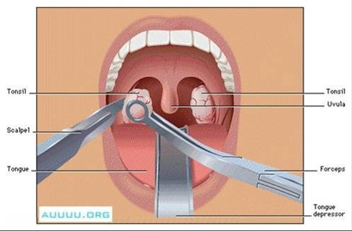 Bé trai Solomon Womack, ở bang Wisconsin, Hoa Kỳ đã được phẫu thuật cắt amidan vào ngày 9/2 vừa qua tại một bệnh viện ngoại trú. Sau khi phẫu thuật, sức khỏe vẫn của em vẫn không vấn đề gì.