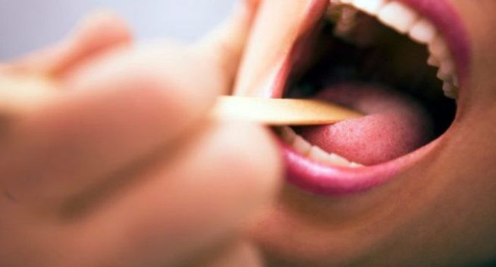 Khi các tế bào ung thư môi phát triển thì vùng da môi có thể chuyển sang màu nhợt hơn hoặc đen sạm lại. Ảnh: amazonaws.