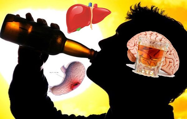 Rượu bia. Kết luận của Tổ chức Nghiên cứu Ung thư quốc tế (IARC) cho thấy rượu bia là chất gây ung thư khoang miệng, họng, thanh quản, thực quản, đại trực tràng, gan và ung thư vú ở phụ nữ. Tiêu thụ rượu bia ở mức độ nào cũng có nguy cơ ung thư.
