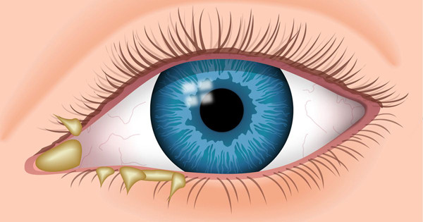 Chẳng hạn, nếu gan bị tổn thương, mắt sẽ có dấu hiệu sưng đỏ, tiết dịch, khô và nhìn kém. Nếu mắt sáng, ít dịch thì đó là tín hiệu đáng mừng, chứng tỏ gan đang hoạt động tốt. Ảnh: Internet