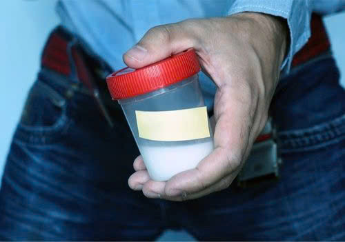 Tinh dịch thấp: Testosteron đóng vai trò quan trọng trong sự sản xuất tinh dịch. Nam giới càng nhiều testosteron thì tinh dịch của anh ta càng nhiều. Đàn ông bị thiếu testosteron sẽ giảm thể tích dịch được phóng ra khi xuất tinh. Ảnh minh họa