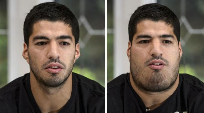Tiền đạo Luis Suarez của Barca với chiếc cổ 3 ngấn.