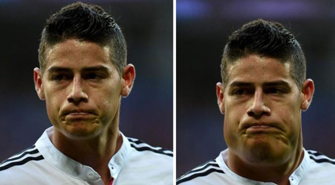Tiền vệ James Rodriguez của Real Madrid béo không đều.