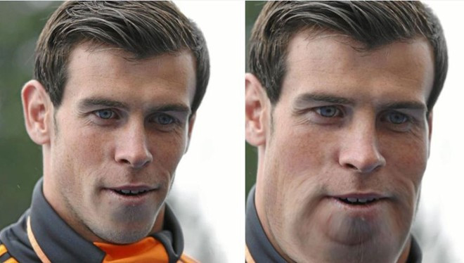 Gương mặt của Gareth Bale sẽ cân đối hơn nếu tăng cân.