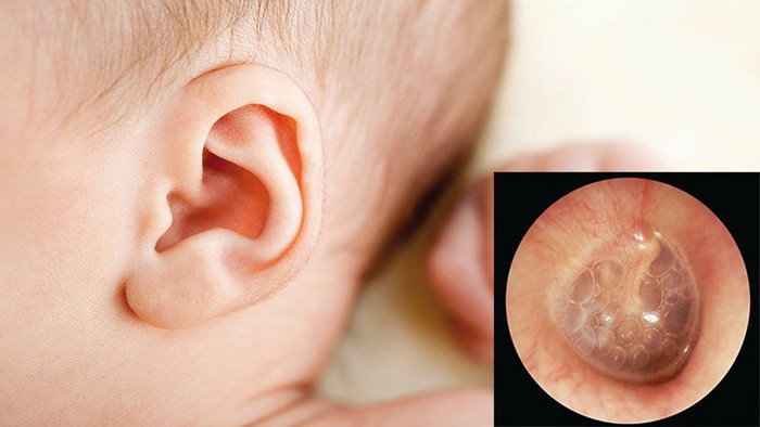 Cấu tạo tai khiến trẻ không thể đưa sâu tay vào trong tác động. Chính vì vậy, con chỉ biết bứt vành tai bên ngoài để biểu hiện sự khó chịu.