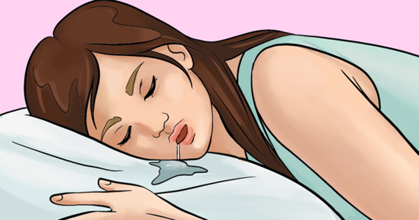 1. Chảy dãi khi ngủ. Chảy dãi khi ngủ là một trong những dấu hiệu nhồi máu não. Mạch máu não tắc nghẽn ảnh hưởng đến sự phối hợp của các cơ và dây thần kinh. Đặc biệt, nó tác động rõ rệt đến các cơ ở khoang miệng, gây ra hiện tượng chảy dãi.