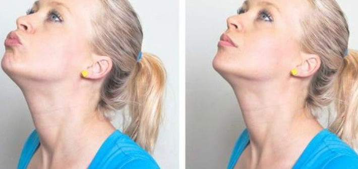 Bên cạnh đó, bạn cũng cần hạn chế tiêu thụ carbs tinh luyện bởi nó có thể làm tăng lượng đường trong máu, ăn quá nhiều và tăng chất béo tích tụ trong cơ thể và trên khuôn mặt. Ảnh: prothomalo.