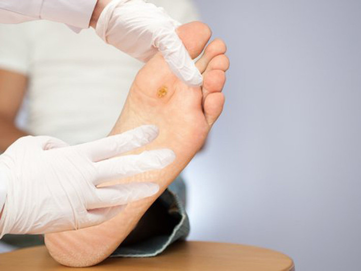 Ngoài ra, bệnh về thần kinh là một trong những biến chứng phổ biến nhất của bệnh tiểu đường. Ảnh: bacsituvan.