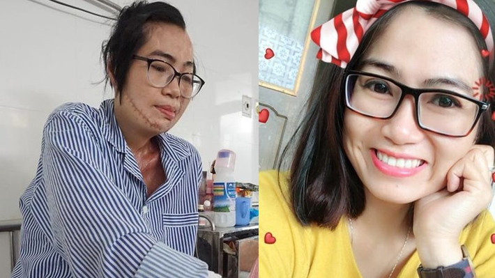 4. Cô giáo bị chồng cũ tạt axit: Năm 2018, Đặng Thị Thanh Huyền (34 tuổi, trú tại Gia Lâm, Hà Nội) và Phạm Văn Thông (36 tuổi) đã hoàn tất thủ tục ly hôn. Tuy nhiên, dịp Tết Nguyên đán, Phạm Văn Thông qua nhà xin lỗi bố mẹ vợ, năn nỉ Huyền quay về chung sống, dù thủ tục ly hôn đã hoàn tất.