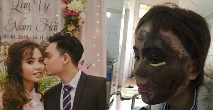 1. Thiếu úy Công an tạt axit vợ sắp cưới: Ngày 1/1/2019, Nguyễn Trương Nam Hải (SN 1995, trú quận Thanh Khê, Đà Nẵng), nguyên là Thiếu úy thuộc lực lượng Cảnh sát PCCC Công an Đà Nẵng, đã dùng axit tại vào người chị Lê Thị Lan Vy (SN 1995, trú quận Thanh Khê).