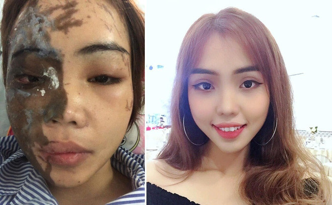 1. Thiếu úy Công an tạt axit vợ sắp cưới: Ngày 1/1/2019, Nguyễn Trương Nam Hải (SN 1995, trú quận Thanh Khê, Đà Nẵng), nguyên là Thiếu úy thuộc lực lượng Cảnh sát PCCC Công an Đà Nẵng, đã dùng axit tại vào người chị Lê Thị Lan Vy (SN 1995, trú quận Thanh Khê).