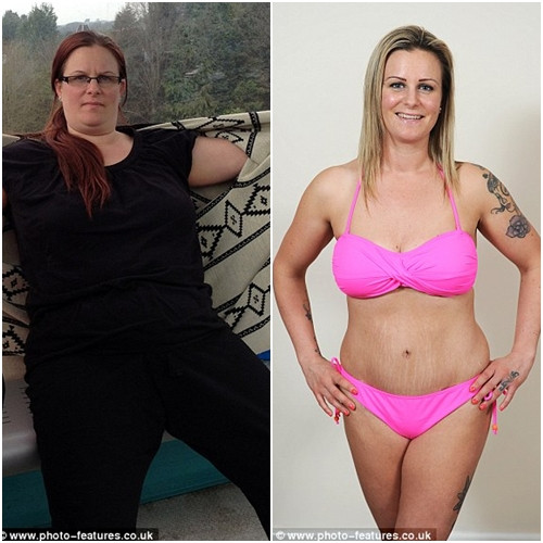 Cô Natalie Davis, 35 tuổi, sống tại Manchester (Anh) đã giảm được 44kg sau 7 tháng ăn kiêng. Tuy nhiên, hậu quả đi kèm khiến bụng cô lùng nhùng da thừa xấu xí.