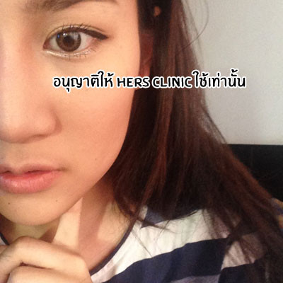 Tại đây, cô đã trình bày ý định muốn cắt bỏ phần mỡ thừa trên má để có được gương mặt thon gọn hơn thay vì phải phẫu thuật gọt hàm và độn cằm.