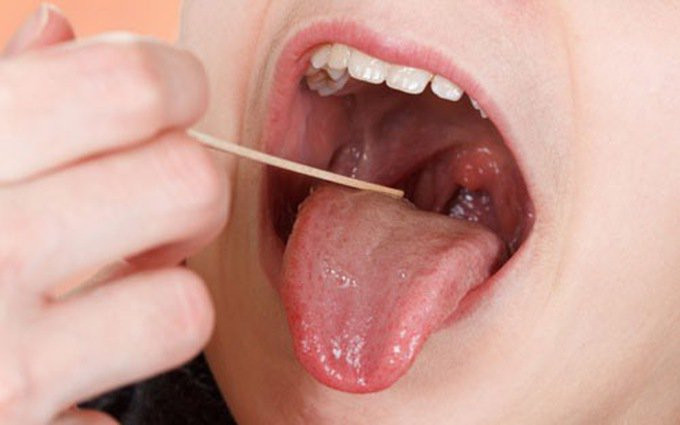Nếu bạn bị ngạt mũi một bên, lúc đầu ngạt từng lúc, kèm theo chảy máu mũi thì đây cũng có thể là dấu hiệu cảnh báo ung thư vòm họng. Ảnh: amazonaws.
