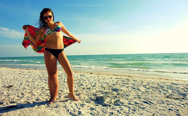Isa-Bella Leclair, 19 tuổi, đến từ Campbellton, New Brunswick, Canada mắc chứng bệnh di truyền hiếm gặp gây hiện tượng chân to chân nhỏ (Parkes Weber Syndrome).