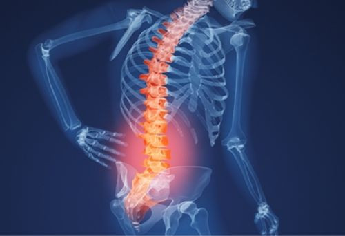 Nếu bạn có những cơn đau lưng dưới, hãy tìm hiểu nguyên nhân chính xác. Một số nguyên nhân có thể là ngồi lâu, đi nhiều nhưng cũng có thể một số nguyên nhân sâu xa hơn như là các bệnh thoái hóa, chấn thương…