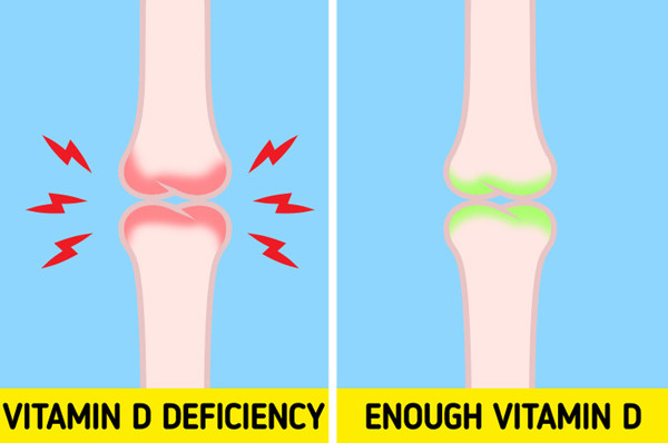 Đau nhức xương. Vitamin D đóng vai trò quan trọng trong việc hấp thụ canxi và chuyển hoá xương. Thiếu chất này làm tăng nguy cơ mắc các bệnh viêm khớp dạng thấp. Thực tế, hầu hết trường hợp đau cơ mãn tính và các vấn đề liên quan đến xương thường liên quan đến thiếu vitamin D.