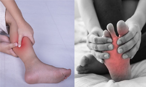 Hiện tượng chuột rút có tên khoa học là co thắt cơ. Biểu hiện chuột rút khi ngủ là sự co thắt cơ đột ngột, thường xảy ra ở cơ bắp chân, cơ đùi và cơ bàn chân. Chuột rút khi ngủ xảy ra ở mọi lứa tuổi nhưng có xu hướng tăng dần theo độ tuổi. (Ảnh: SH, minh họa)