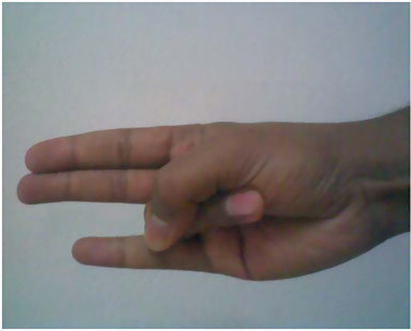 Bài tập thủ ấn Agni Mudra: Phương pháp của người Ấn Độ giúp hòa tan chất béo, thúc đẩy trao đổi chất, làm cho hệ tiêu hóa hoạt động nhuần nhuyễn để hạn chế nguy cơ béo phì. Bài tập này nên được thực hiện vào lúc sáng sớm, lúc chưa ăn gì là tốt nhất.
