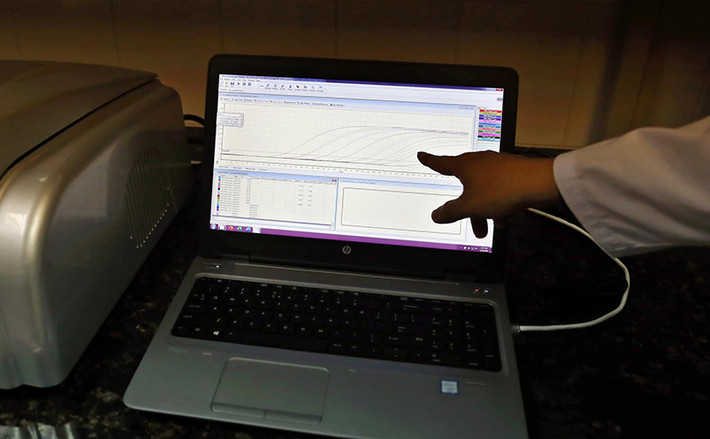 Ưu điểm của hai bộ test này là chỉ qua một lần xét nghiệm và thời gian cho kết quả là 2 giờ đồng hồ (bao gồm cả thời gian chuẩn bị bệnh phẩm). Ảnh: Công Đạt/ Báo Ảnh Việt Nam.