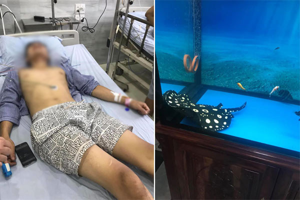 Mới đây, mạng xã hội xôn xao trước trường hợp hai người trong một gia đình phải nhập viện vì trúng nọc độc cá sam cảnh - loài cá vốn được coi thuộc top vật nuôi đẹp và đắt hàng đầu của dân chơi Việt. Câu chuyện được chia sẻ khiến không ít người hoang mang, đặc biệt là những người vốn đam mê và có thú chơi cá cảnh.