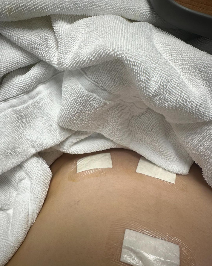 Được biết, cô nàng mổ nội soi và phải mất 1 khoảng thời gian nghỉ ngơi, tĩnh dưỡng để có thể liền sẹo.