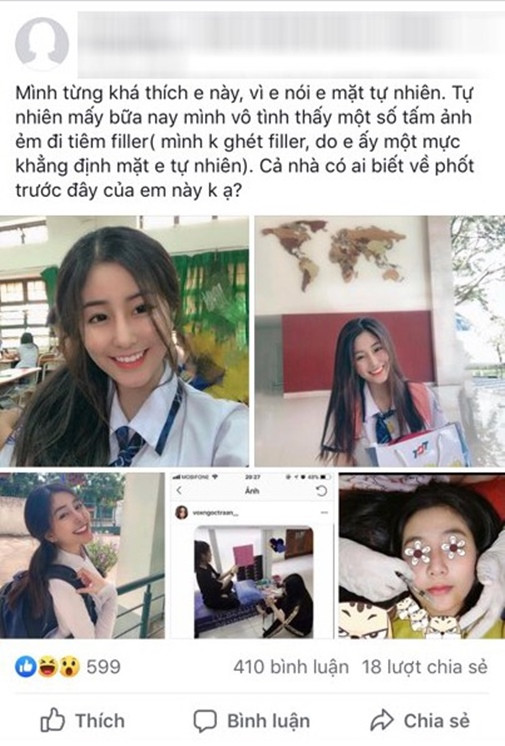 Tuy nhiên, dân mạng liên tục đặt nghi vấn hot girl Ngọc Trân phẫu thuật thẩm mỹ để có được nhan sắc hiện tại dù cô nàng phủ nhận.