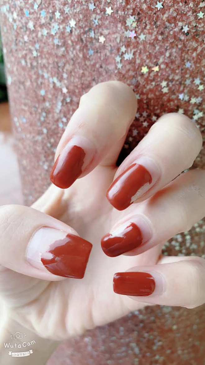 Phần móng nham nhở do "ngứa tay ngồi bóc".