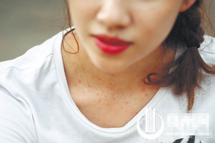 "Mỗi lần làm mẫu đều có những cay đắng", Mã San nói và chỉ tay vào chấm đỏ trên cổ của mình. Cô cho biết trang phục của một số nhà sản xuất có thể khiến làn da của người mẫu gặp dị ứng về chất liệu. Nhiều người cho rằng các người mẫu chỉ cần xinh đẹp còn các nhiếp ảnh gia sẽ có trách nhiệm chụp nhưng một số dáng có thể mất đến vài trăm bức hình mới làm nhiếp ảnh gia hài lòng. Bên cạnh đó, liên tục đi những đôi giày cao gót đã khiến nhiều người mẫu mắc phải vấn đề về chân.