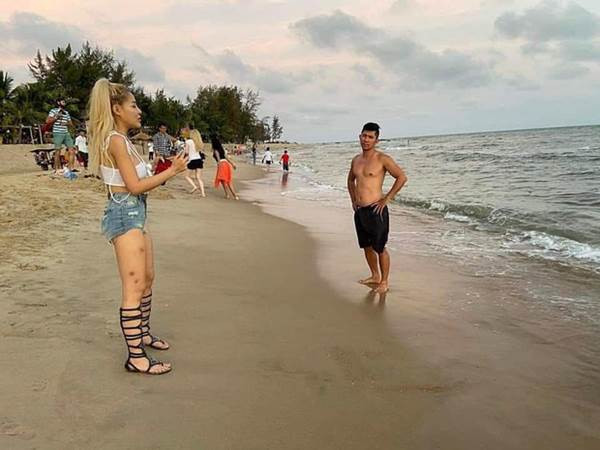 Đôi chân kém nuột nà, nhiều vết thâm của hot girl khác xa với trên ảnh.