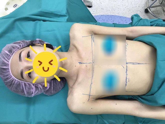 Mong muốn có được màn "lột xác" hoàn hảo, An Kim phải trải qua nhiều cuộc đại phẫu, tiểu phẫu chuyển giới cực kỳ đau đớn để từ một chàng trai trở thành cô gái nữ tính.