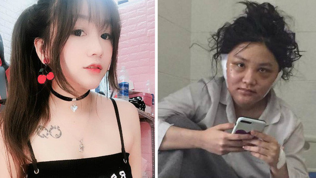 Sau những rùm beng nhạy cảm, Kiều Anh Hera dường như biến mất khỏi mạng xã hội. Sau đó cô bất ngờ lộ những hình ảnh xấu xí trong viện. Được biết cô đi tân trang lại nhan sắc trước khi trở lại với công việc streamer.