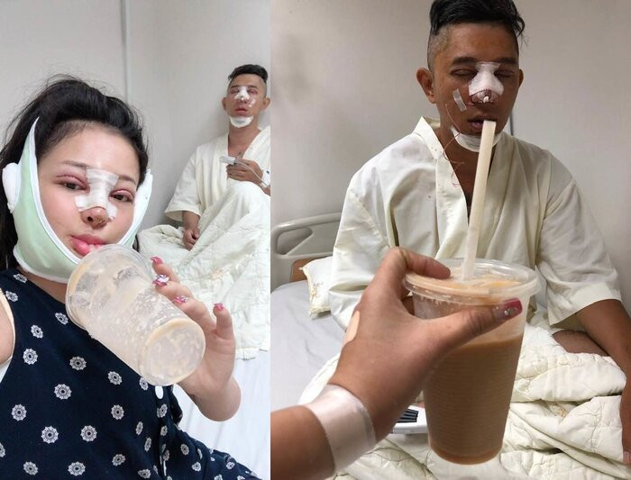 Ngân 98 không ngần ngại công khai hình ảnh họ cùng nhau phẫu thuật thẩm mỹ với chi phí lên đến 140 triệu. Tuy nhận nhiều chỉ trích nhưng cặp đôi quyết định mặc kệ và liên tục chia sẻ những hình ảnh về cuộc “đại tu nhan sắc” của mình.