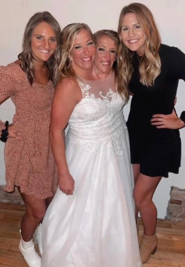 Hai chị em Abby và Brittany cùng anh Josh Bowling đang sinh sống tại bang Minnesota, Mỹ. Đây chính là nơi mà cặp song sinh nhà Hensel sinh ra và lớn lên.