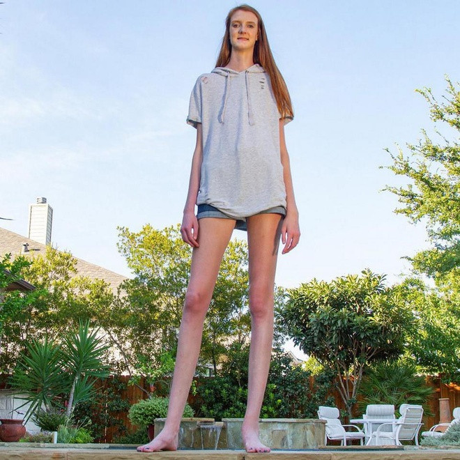 Maci Currin (sinh năm 2003, đến từ Texas, Mỹ) sở hữu chiều cao vượt trội 2,1 m khi mới 16 tuổi. Đặc biệt, đôi chân dài nhất thế giới của cô dài tới 1,34 m - hơn 2 cm so với kỷ lục Guinness thế giới do Ekaterina Lisina nắm giữ từ năm 2017. Lúc mới sinh, Maci cao chưa đến 50 cm. Trong quá trình lớn lên, chiều cao của 10X phát triển chóng mặt. Mới 9 tuổi, cô đã cao 1,7 m.