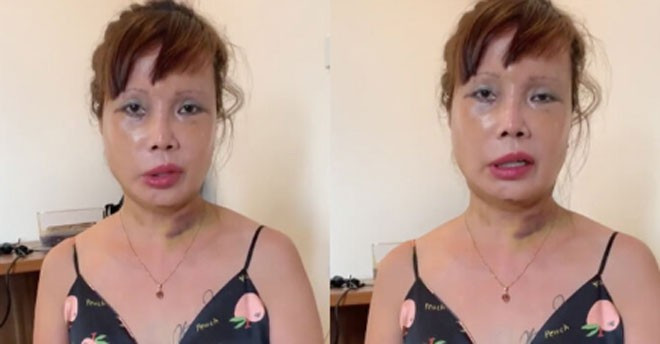 Về phần mình, Thu Sao có vẻ hài lòng với kết quả phẫu thuật nên mới thường xuyên livestream giao lưu với cộng đồng mạng như vậy.
