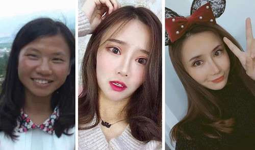 Nhiều thiếu nữ quan niệm rằng phẫu thuật sớm thì xinh sớm nên từ khi học trung học đã bắt đầu thực hiện các tiểu phẫu, đại phẫu khác nhau.