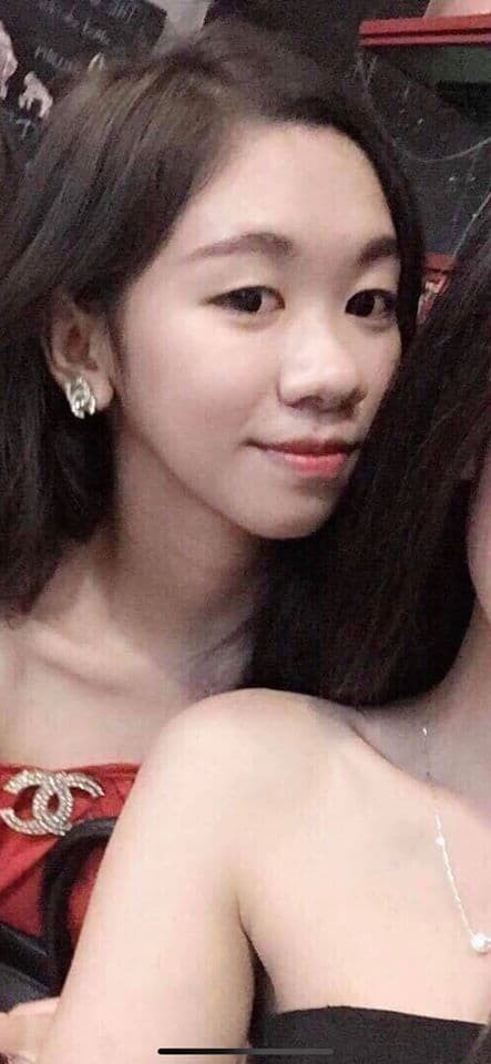 Sau khi chia tay người yêu, cô gái quyết định lột xác nhờ dao kéo và tiêm filler vào môi, má, cằm. "Em năm nay 22 tuổi. Em làm mũi năm 19 tuổi sau khi thi tốt nghiệp xong. Tính đến giờ là mặt em đã làm được hơn 4 năm rồi ạ. Riêng bản thân em cảm thấy, diện mạo quyết định rất nhiều thứ. Khi em thay đổi, em có nhiều cơ hội hơn, mọi điều thuận lợi và may mắn hơn, và ít nhất là em cảm thấy thật sự tự tin", cô gái cho biết.