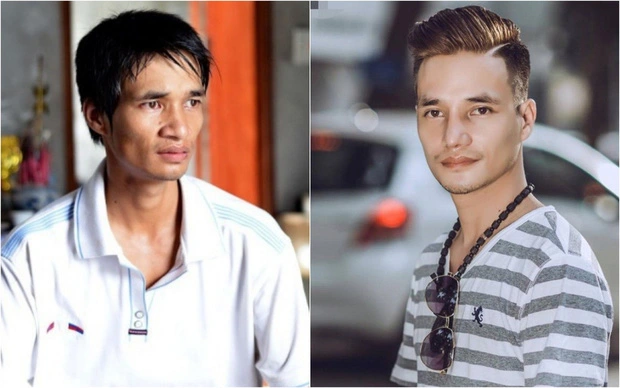 Chàng trai quê Hải Dương còn nhờ dao kéo để tân trang diện mạo.