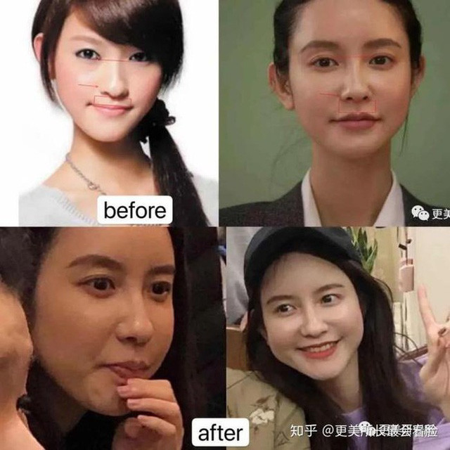 Tuy nhiên, gần đây trên mạng xã hội xuất hiện những bức ảnh được cho là của Trương Đại Dịch khi chưa can thiệp thẩm mỹ. "Bồ nhí" chủ tịch Taobao trong hình không phải quá xấu xí nhưng chẳng mấy nổi bật, các nét trên khuôn mặt kém hài hòa.
