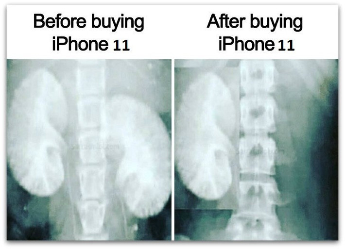 Trước và sau khi mua iPhone 11, cơ thể bạn sẽ thay đổi thế nào?