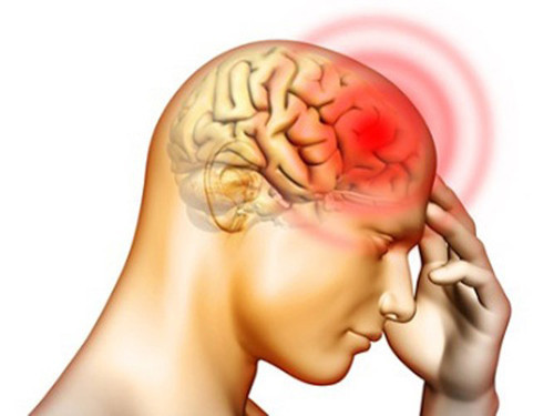Di truyền. Mặc dù chưa tìm ra loại gen cụ thể trong quá trình di truyền từ thế hệ này sang thế hệ khác, nhưng các nhà khoa học vẫn xem yếu tố di truyền là một trong những nguyên nhân ung thư não hàng đầu. Những người có người thân trong gia đình mắc ung thư não nên đi khám sức khỏe thường xuyên để phát hiện sớm nguy cơ mắc bệnh. Ảnh: ehow