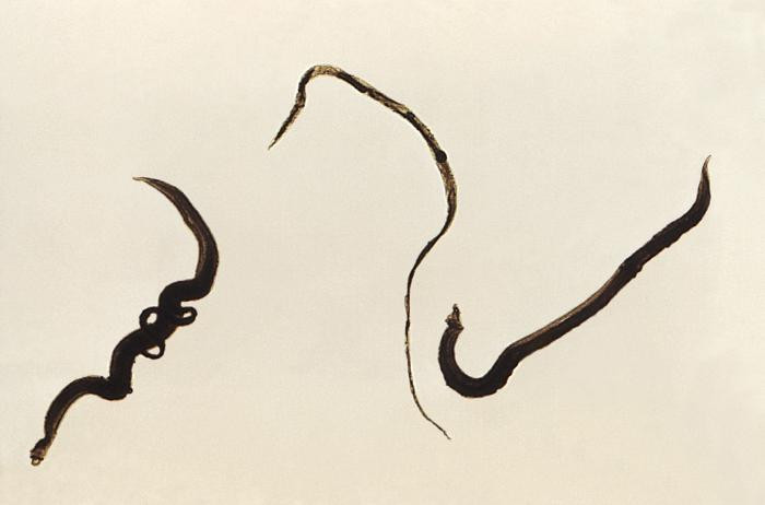 Sán Schistosoma mansoni được ghi nhận có ở châu Phi, Trung Đông, Caribbean, Brazil, Venezuela. Ảnh ppdictionary.