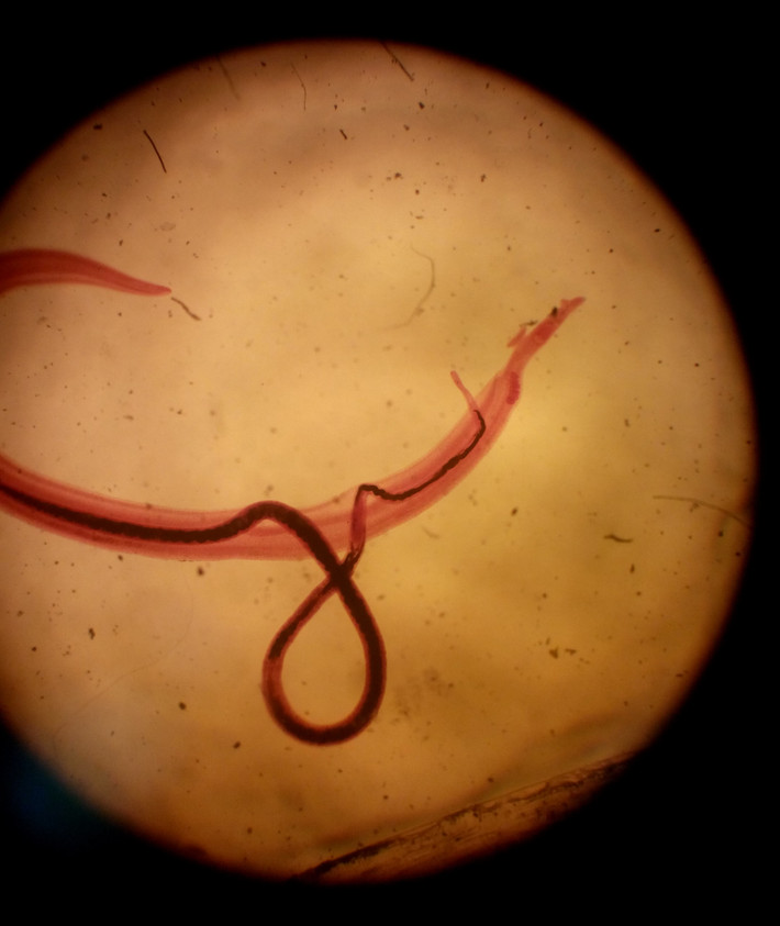 Trong suốt quá trình sinh sản hữu tính bên trong cơ thể người, sán Schistosoma mansoni hình thành liên kết đôi theo kiểu một vợ một chồng. Ảnh wikimedia.