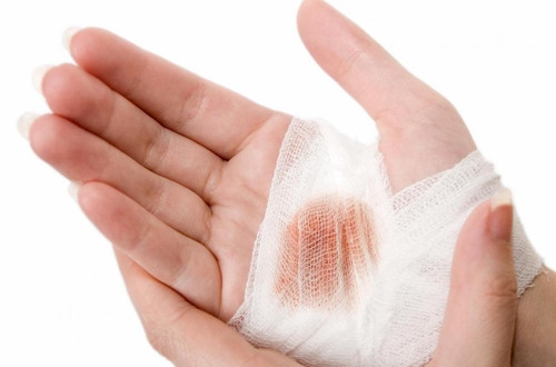 Cách dùng: Bạn lấy 12 - 20g rau ngổ rửa sạch, đem sắc với nước, uống trong ngày. Nếu muốn cầm máu vết thương, bạn chỉ cần lấy cây rau ngổ tươi rửa sạch, giã nát, đắp vào vết thương và cố định lại bằng gạc vô trùng.