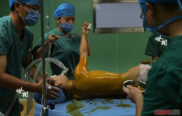 Wang được tiệt trùng trước khi phẫu thuật.